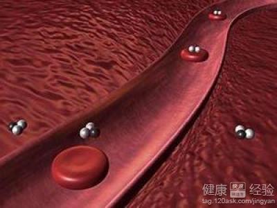 高血脂怎麼引起