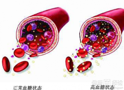 高血糖超過正常人會引起別的什麼病症嗎