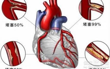 心腦血管患者冬季保健要合理膳食