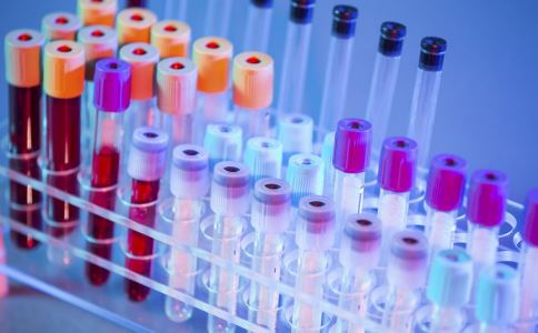 血脂異常一定要早預防早控制 血脂異常的預防 如何預防血脂異常 怎樣預防高血脂