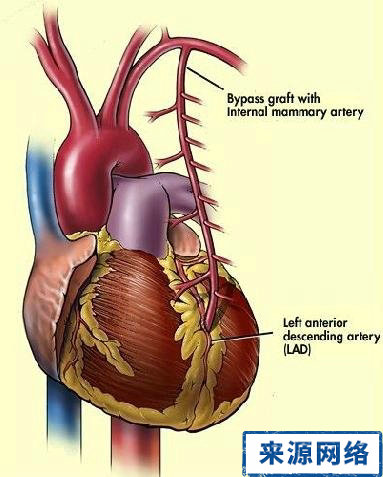 心律失常 心髒性猝死 高危人群 冠心病患者 心衰患者